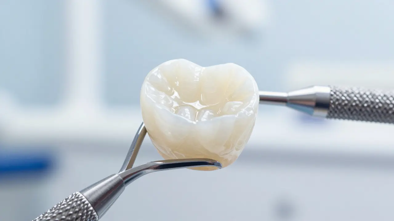 Jak dlouho vydrží zirkonové zuby? Životnost, výhody a realita